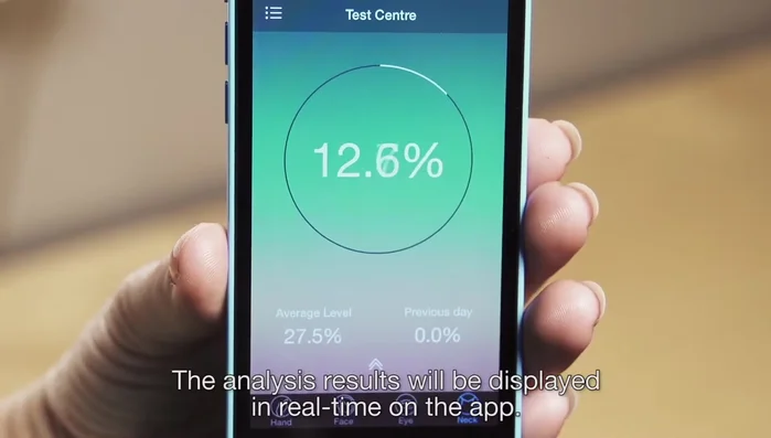 View the real-time analysis results on the app. Click 'view detailed results' for skincare tips.