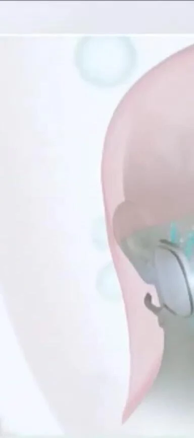 Close-up of Slendertone Face device controls.