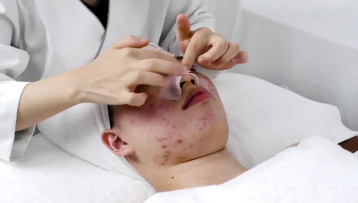 Apply blackhead export liquid to the treatment area (T-zone) for 5-8 minutes