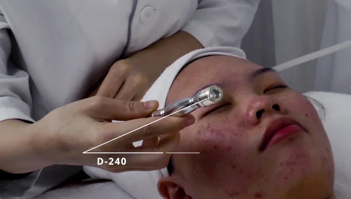 Switch to different tips (D200, D182) and adjust suction according to comfort level