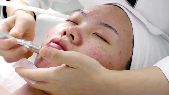 Switch to different tips (D200, D182) and adjust suction according to comfort level