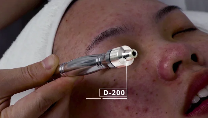 Use flat tube on forehead; use index finger to control suction