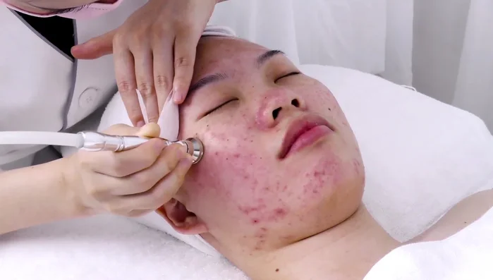 Use flat tube on forehead; use index finger to control suction