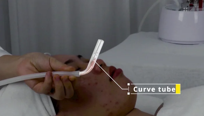Use curved tube on chin and cheeks