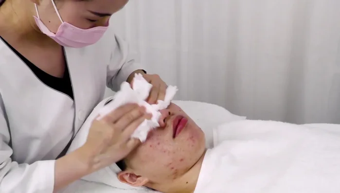 Remove mask, clean treatment area, and continue with regular skincare routine