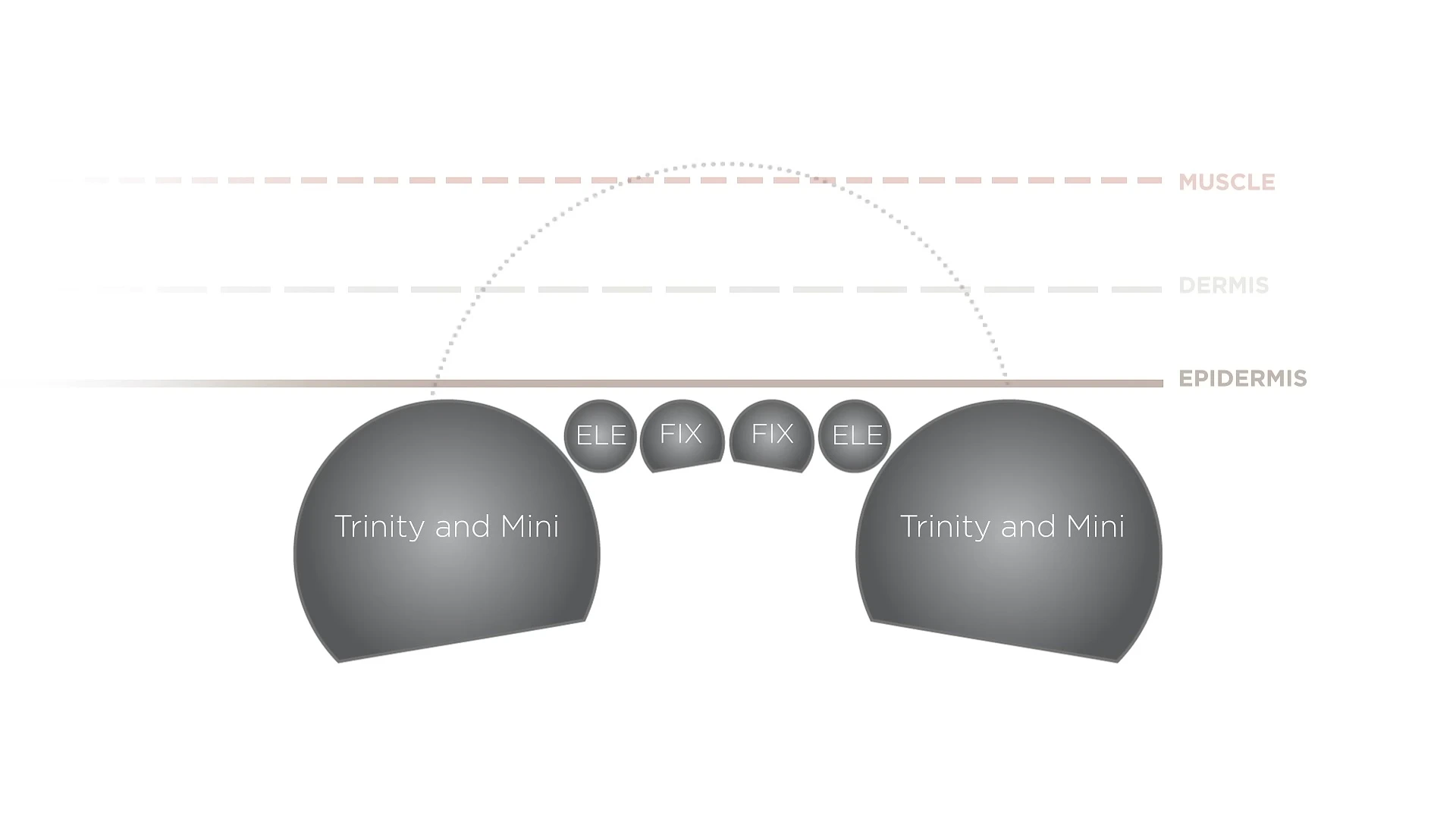 Visual summary comparing all three NuFACE devices