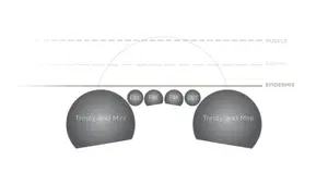 NuFACE Devices: A Comprehensive Comparison of Trinity, Mini, and Fix