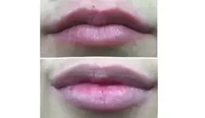 Candy Lipz Lip Plumping System Review: Apple & Grape Plumpers