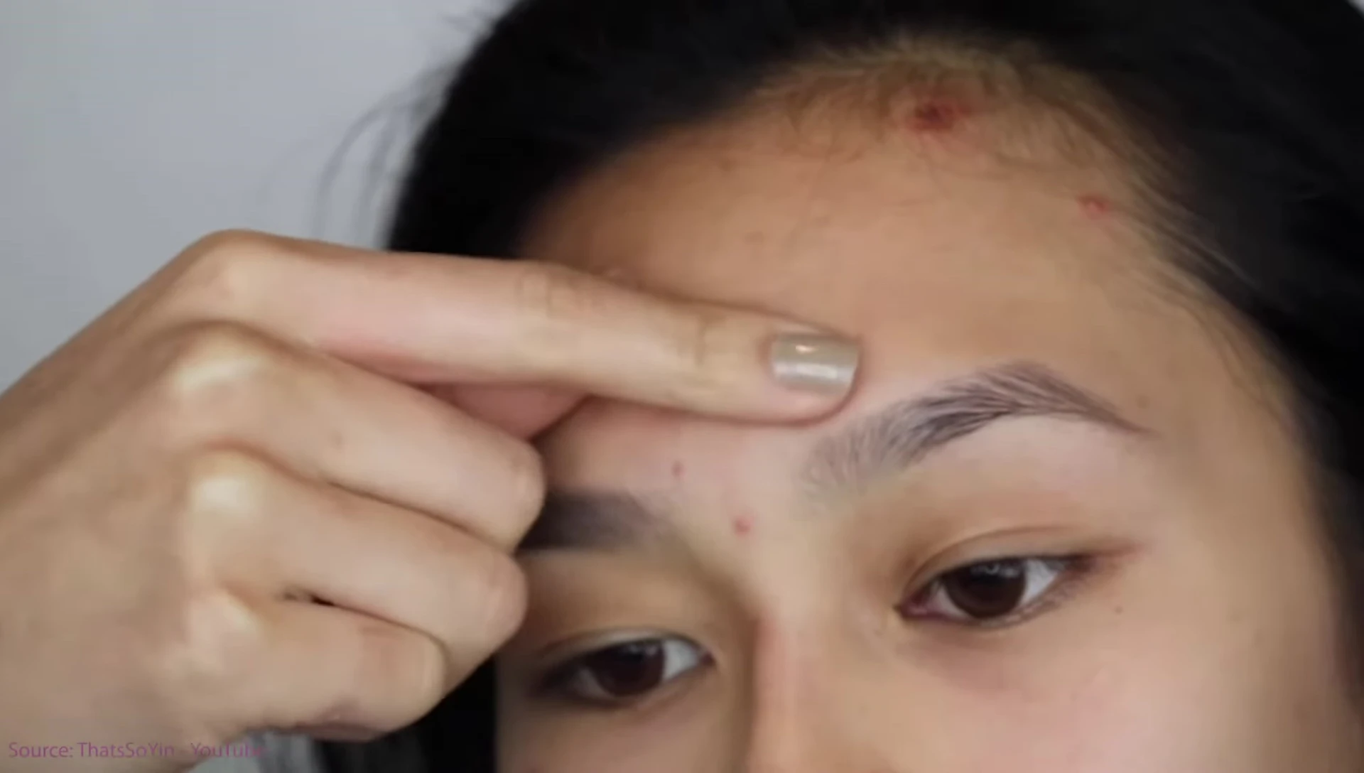 Peach Slices pimple patches shown.