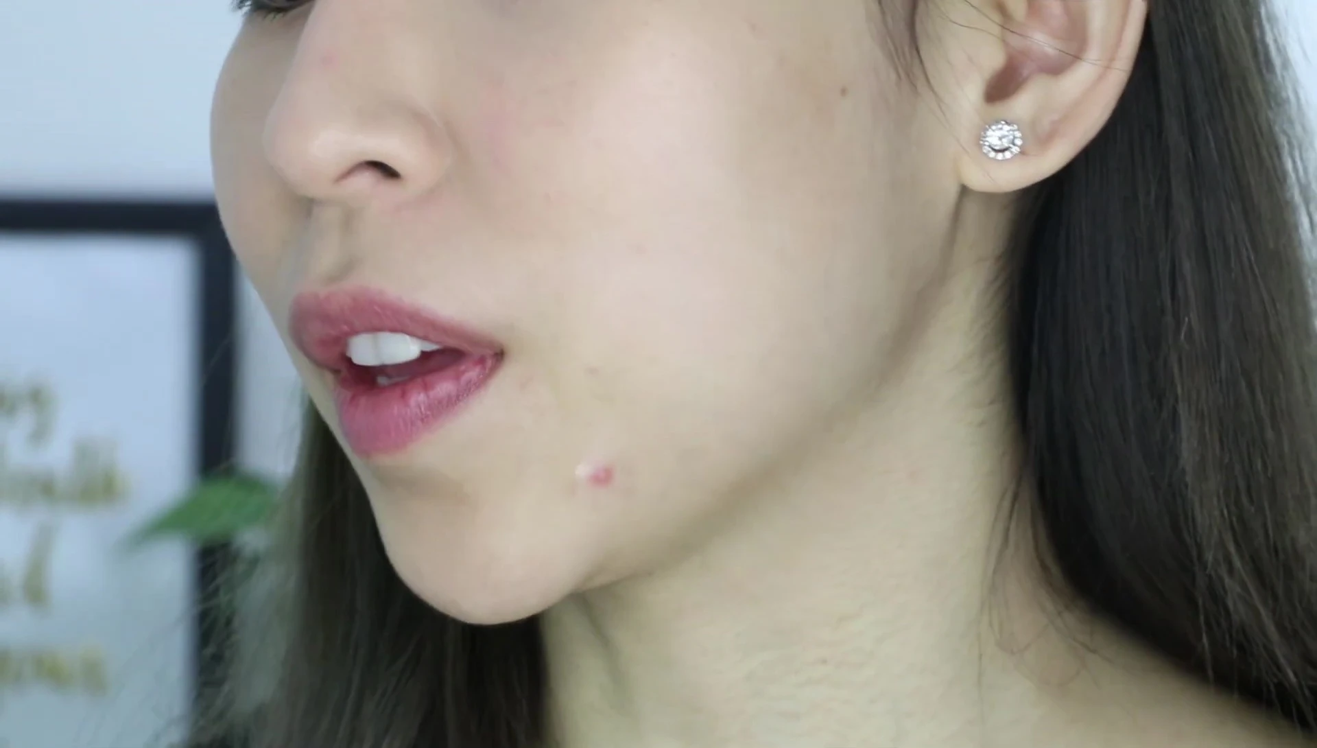Close up shot of the blemish dot applied on the pimple showing the shine.