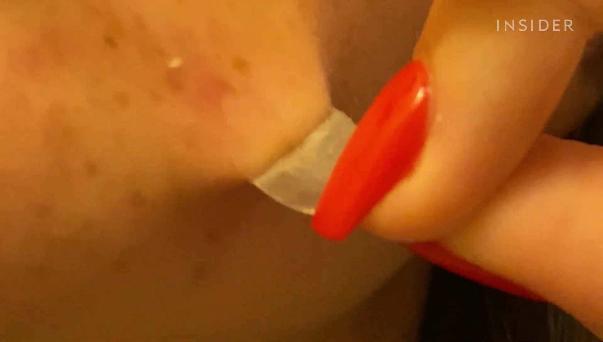 Image of several used Mighty Patches showing absorbed fluids