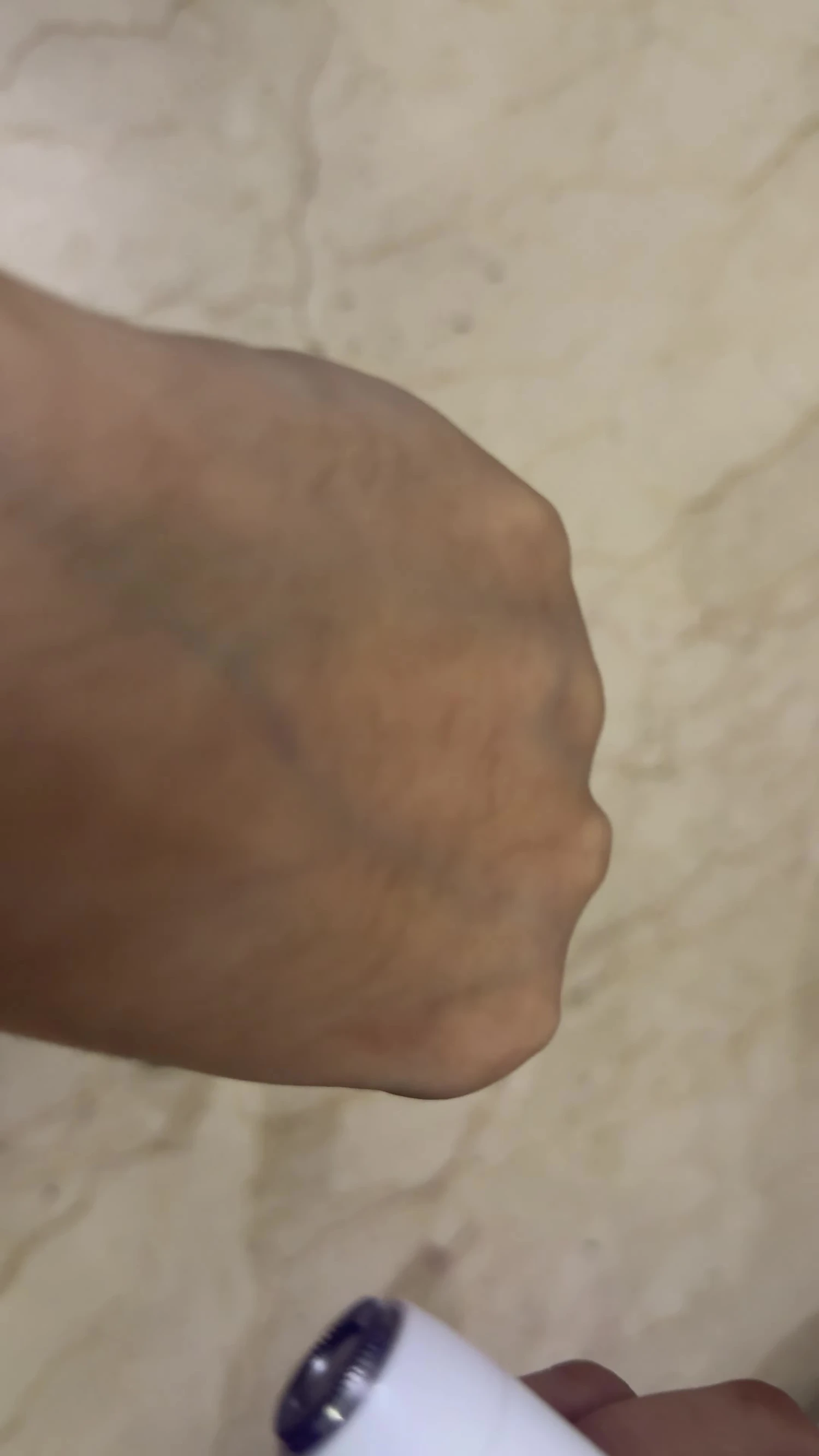 Close-up on the reviewer's face, before applying the device.