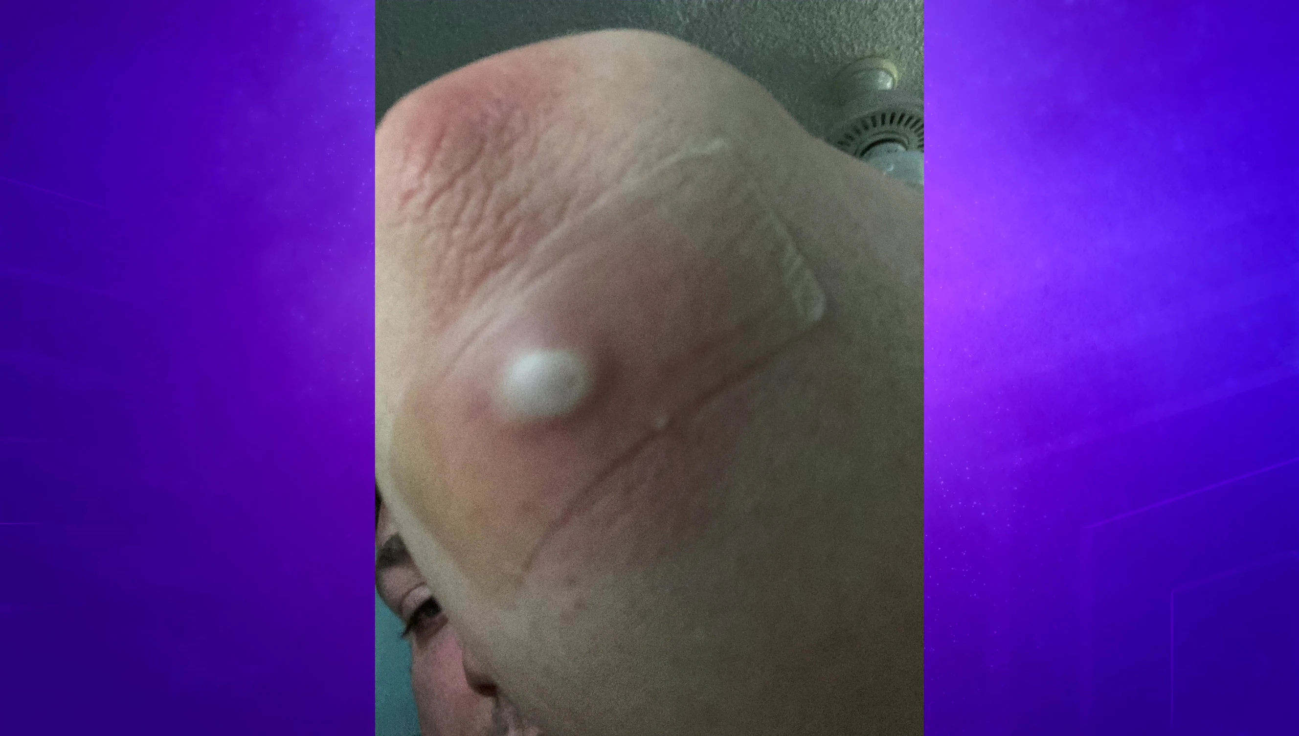The reviewer showing a result after removing the patch.
