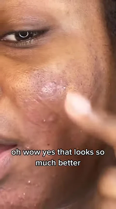 The speaker showing off the results after using the patches.