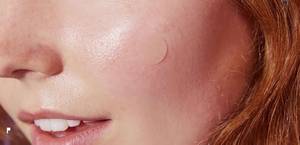 COSRX vs Mighty Patch: Best Acne Pimple Patch?