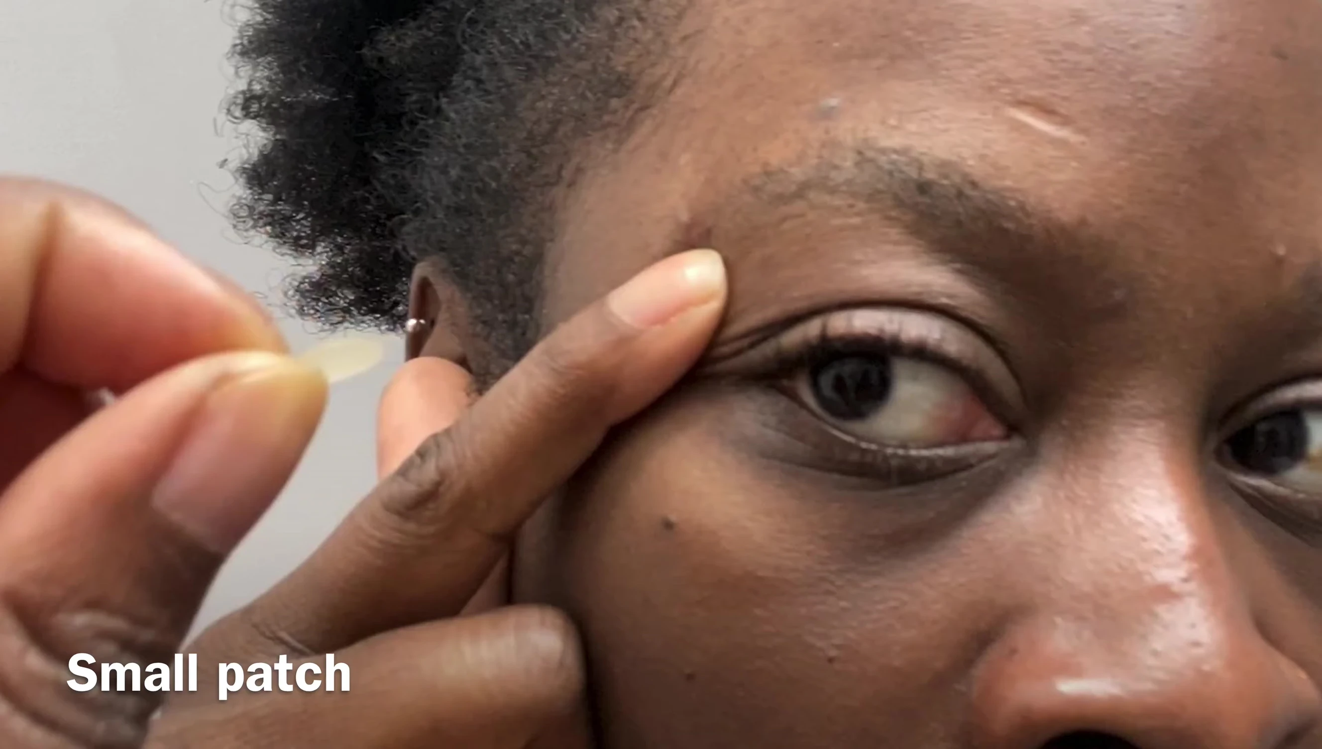 Applying a pimple patch to a small pimple.