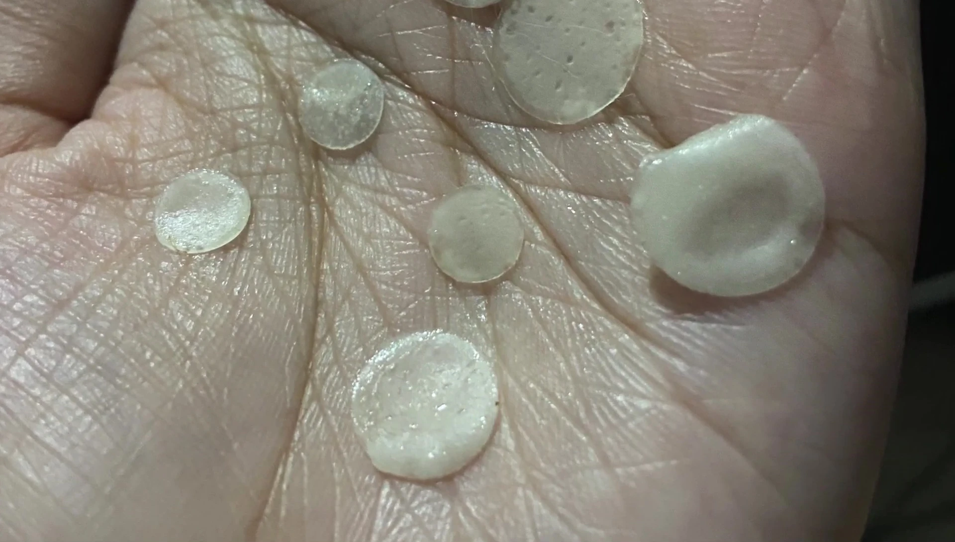 The YouTuber shows her face after using the patches overnight.