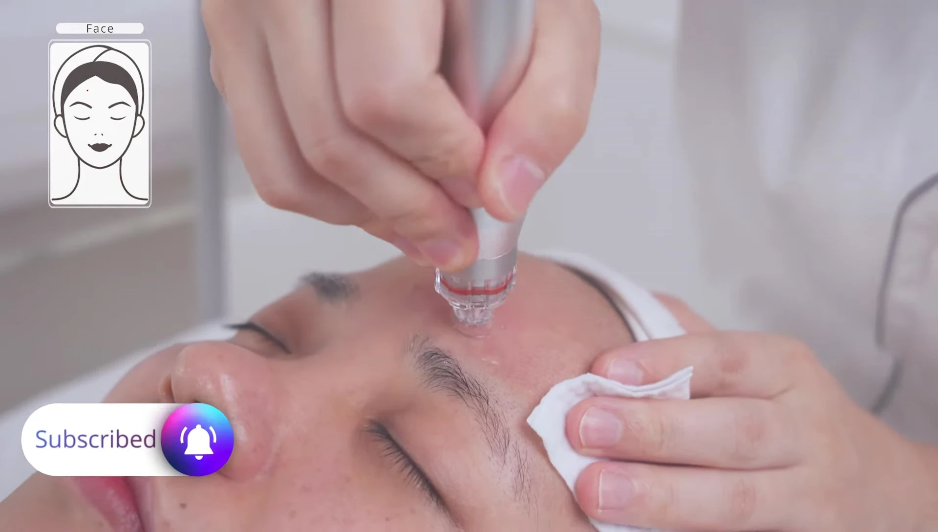 Targeting congested areas with the hydrofacial