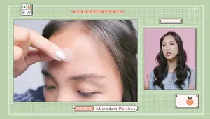 Pimple Patches: Hydrocolloid vs. Microdots - Which Works Best?