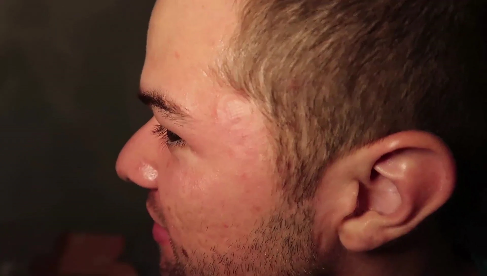 The speaker showing the patch applied to their skin.