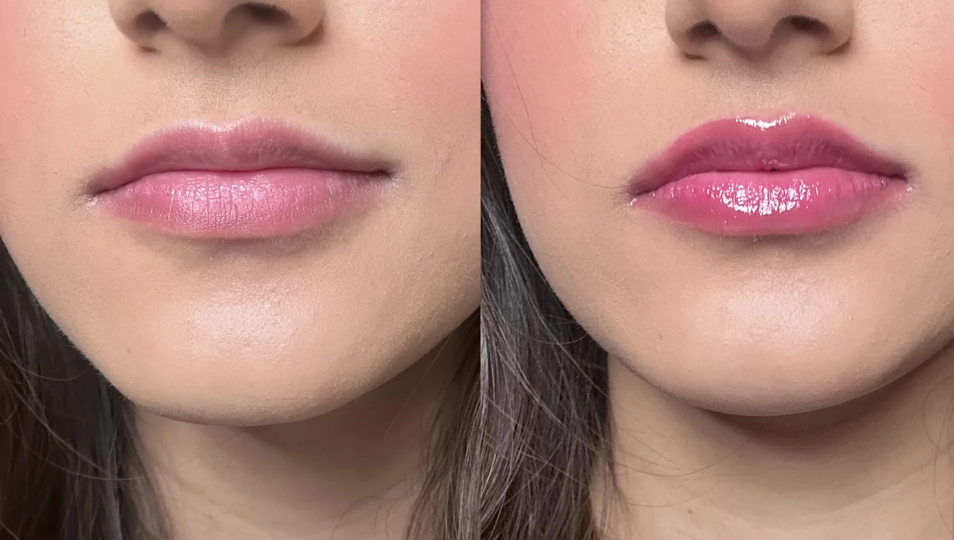 Before and after lip comparison using Too Faced Lip Injection Extreme