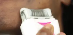 Epilator for Facial Hair Removal: A Personal Review and Tips