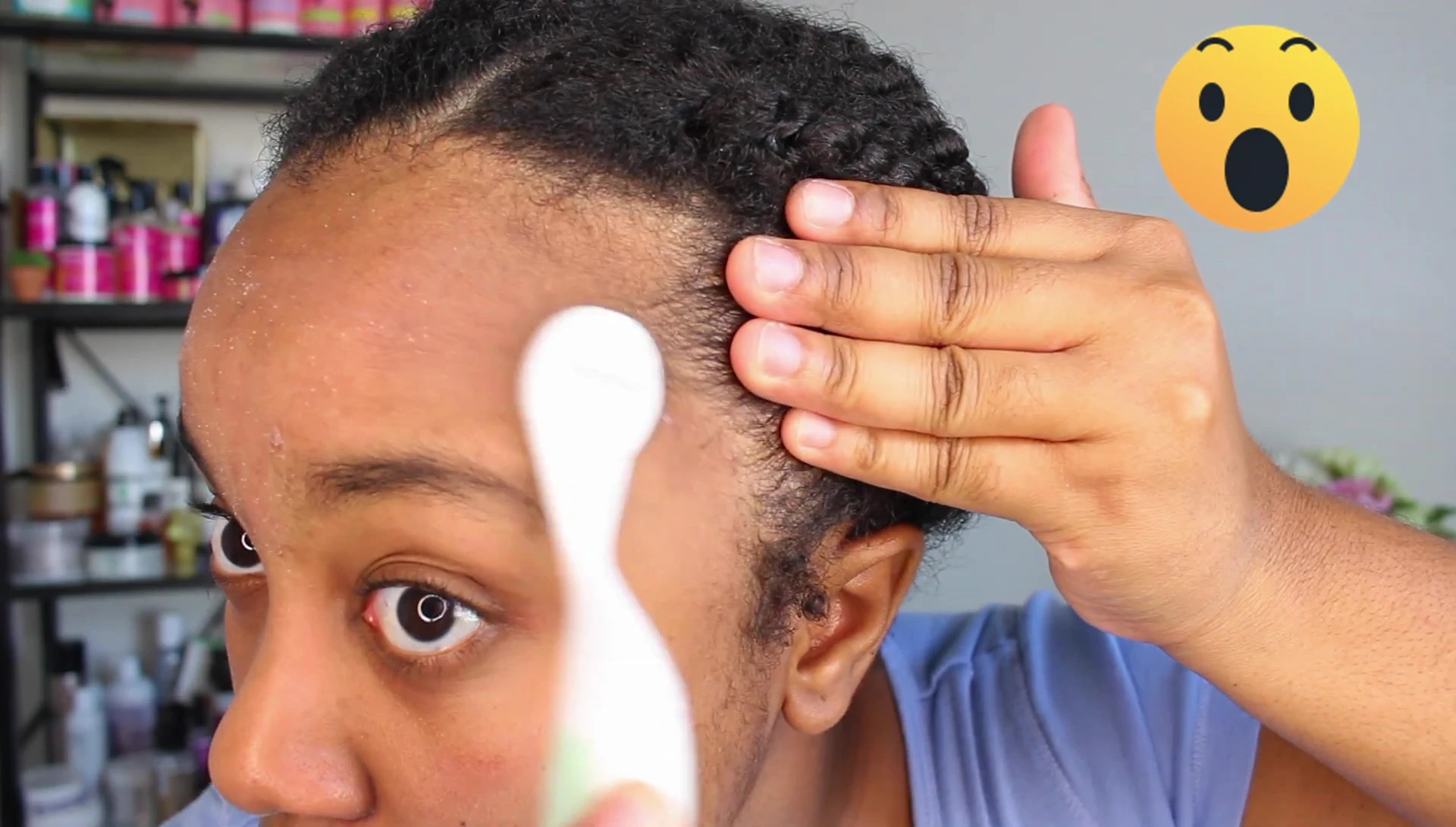 Close up showing skin peeling after the treatment